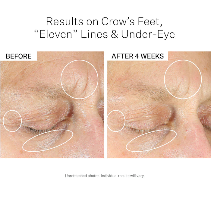 StriVectin-SD Eye Serum Concentrate for Wrinkles