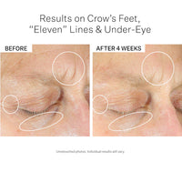 Thumbnail for StriVectin-SD Eye Serum Concentrate for Wrinkles