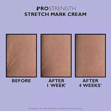 Peter Thomas Roth Pro Strength Stretch Mark Cream