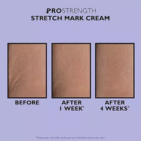 Thumbnail for Peter Thomas Roth Pro Strength Stretch Mark Cream